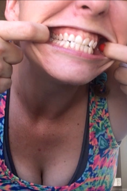 Brushing My Teeth In The Sink